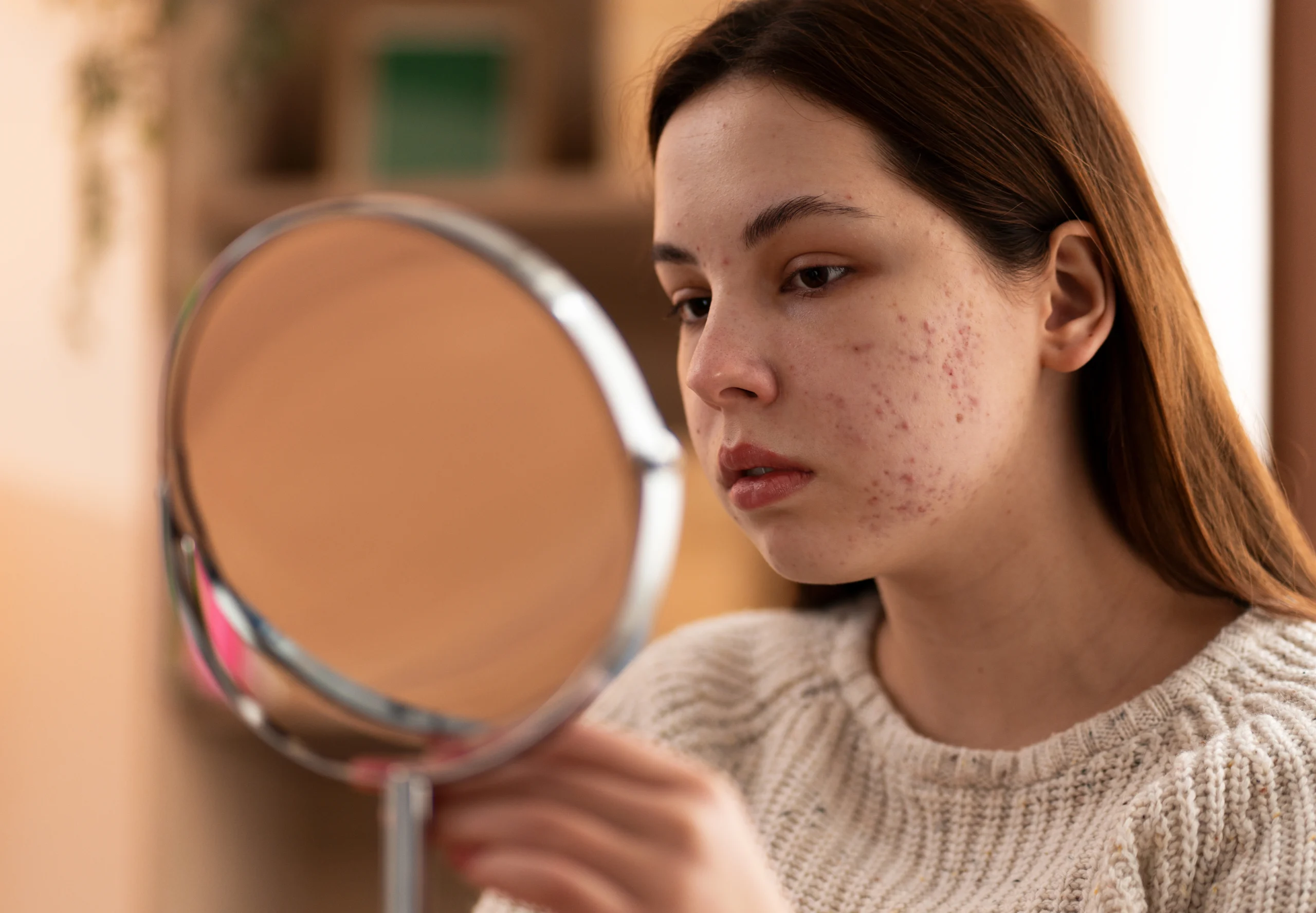 Acne and Acne Scar Treatment